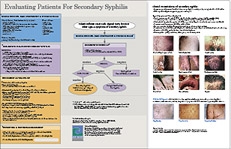 Syphilis Secondary Algortihm